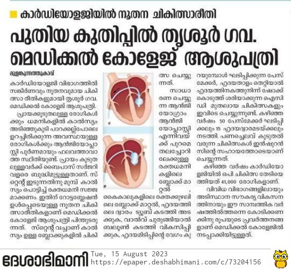 Sophisticated Treatments under Cardiology Department